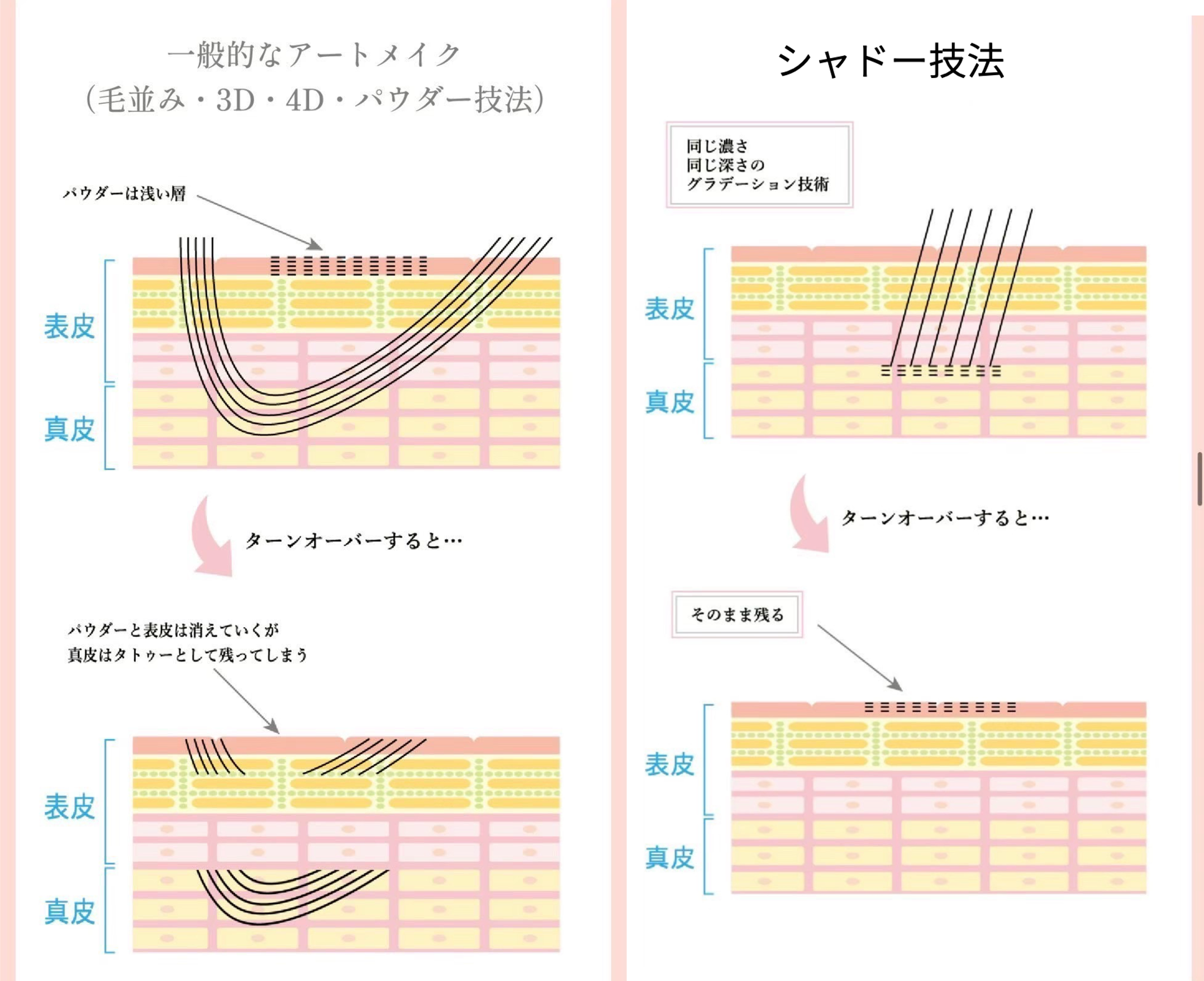 一般的なアートメイクとシャドー技法の比較図